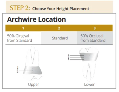 Bicuspid Band pre-weld, with Weldable brackets, Sinterline Plus™